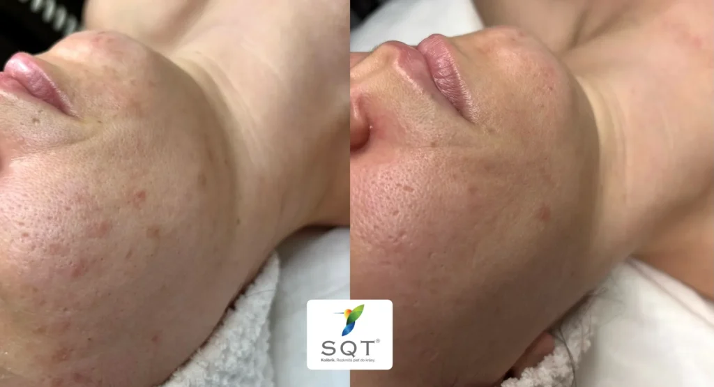 Lashlift mihalníc Bratislava
